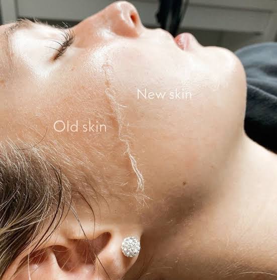 Dermaplanning at Maison Montclair